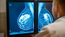 Breast cancer screening delays may have harmed patients