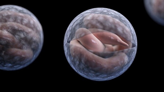 Cryptosporidiosis is a disease caused by a microscopic germ (parasite) called Cryptosporidium. Image / CDC