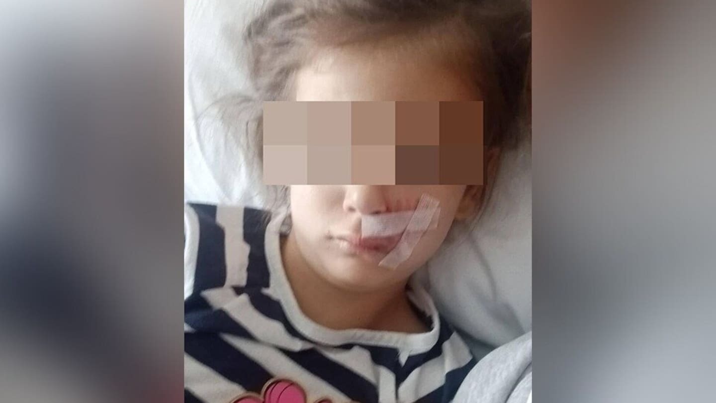 'Vicious' dog attack leaves 6-year-old scarred for life
