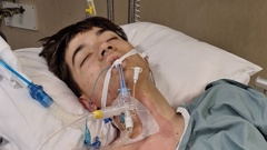 Christopher Junior (CJ) Holmes had his leg amputated at Lower Hutt hospital after he was accidentally bowled by a skidding car.