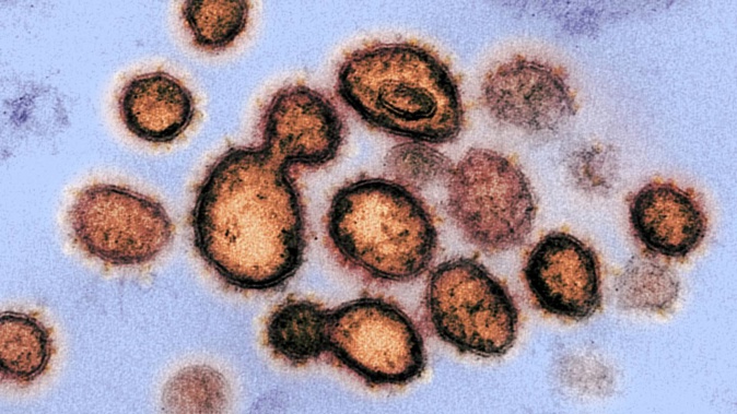 A heavily-mutated Omicron subvariant causing a global stir is yet to pop up in New Zealand – but an ESR scientist expects it’s just a matter of time before it’s detected here.