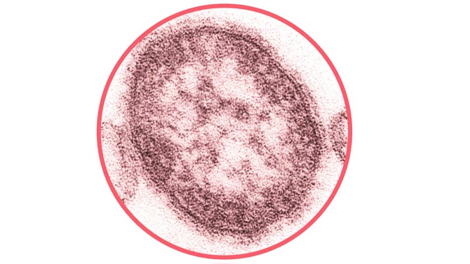 An electron micrograph of the measles virus. Photo / Cynthia S. Goldsmith, CDC