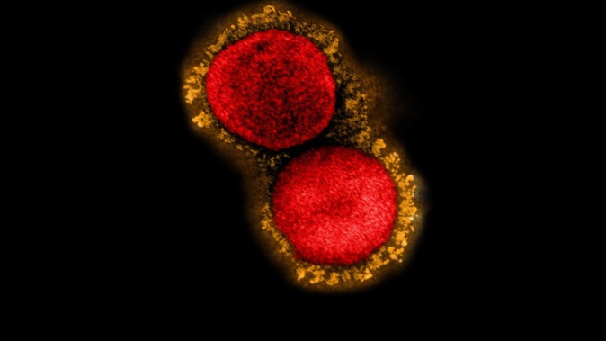 The Ministry of Health is providing a regular update on Covid-19 case numbers. Image / NIAID