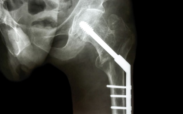 Radiology services provision in New Zealand has been the subject of fraught debates in recent years. Photo: 123rf