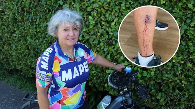 'Terrifying': Trail cyclist, 69, attacked by dogs twice in four weeks