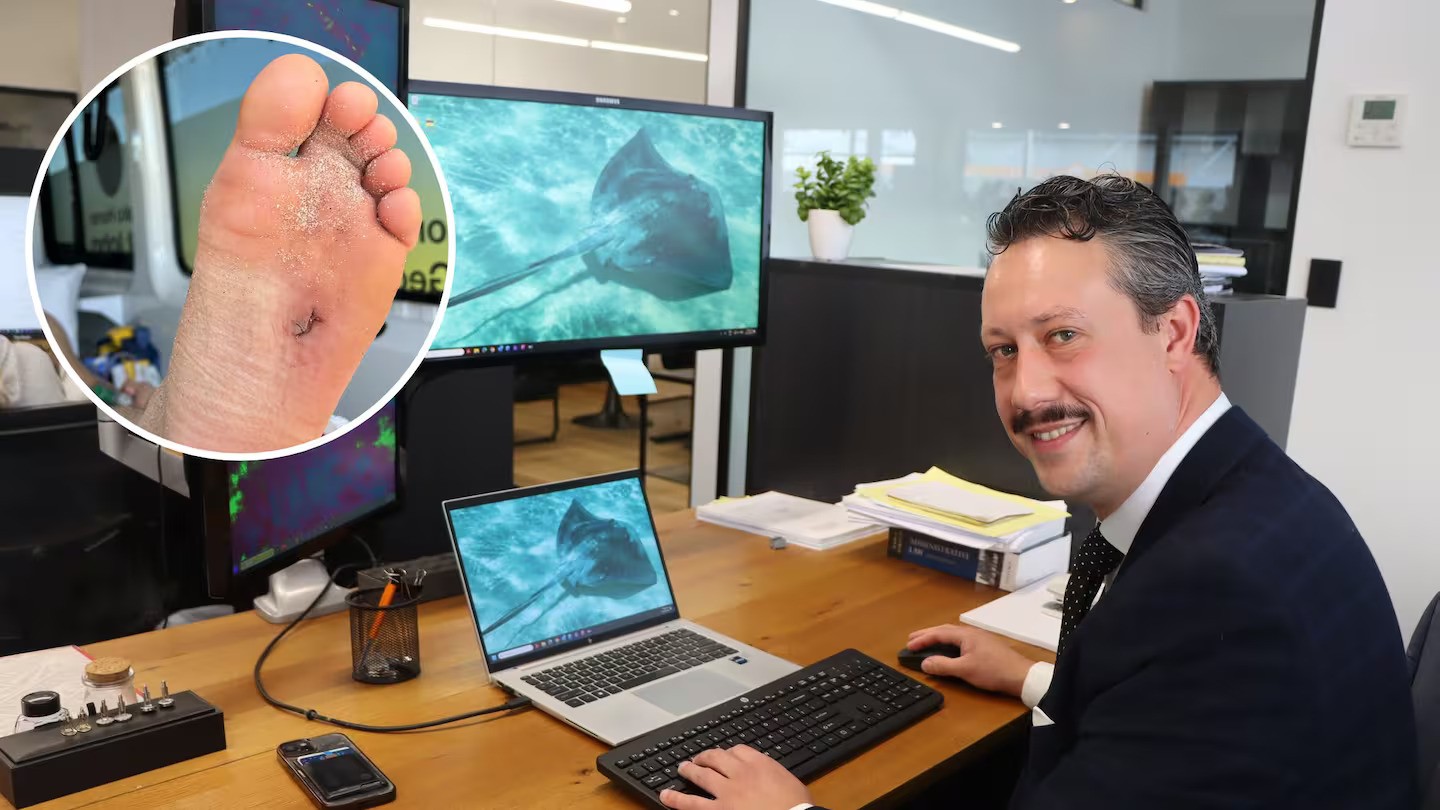 Stingray encounter: Lawyer felt a 'chomp' on his foot at the beach ... then came the blood