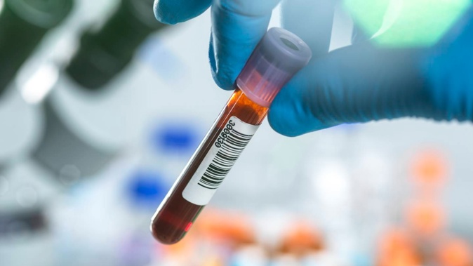 Community Anatomic Pathology in Auckland recently lost its histology accreditation. Photo / Getty Images