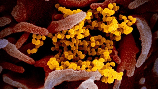 Covid-19 cases in New Zealand have dwindled to their lowest numbers since the pandemic began, as a modeller says the coronavirus appears to be finding fewer “evolutionary niches” to infect us. Photo / NIAID-RML
