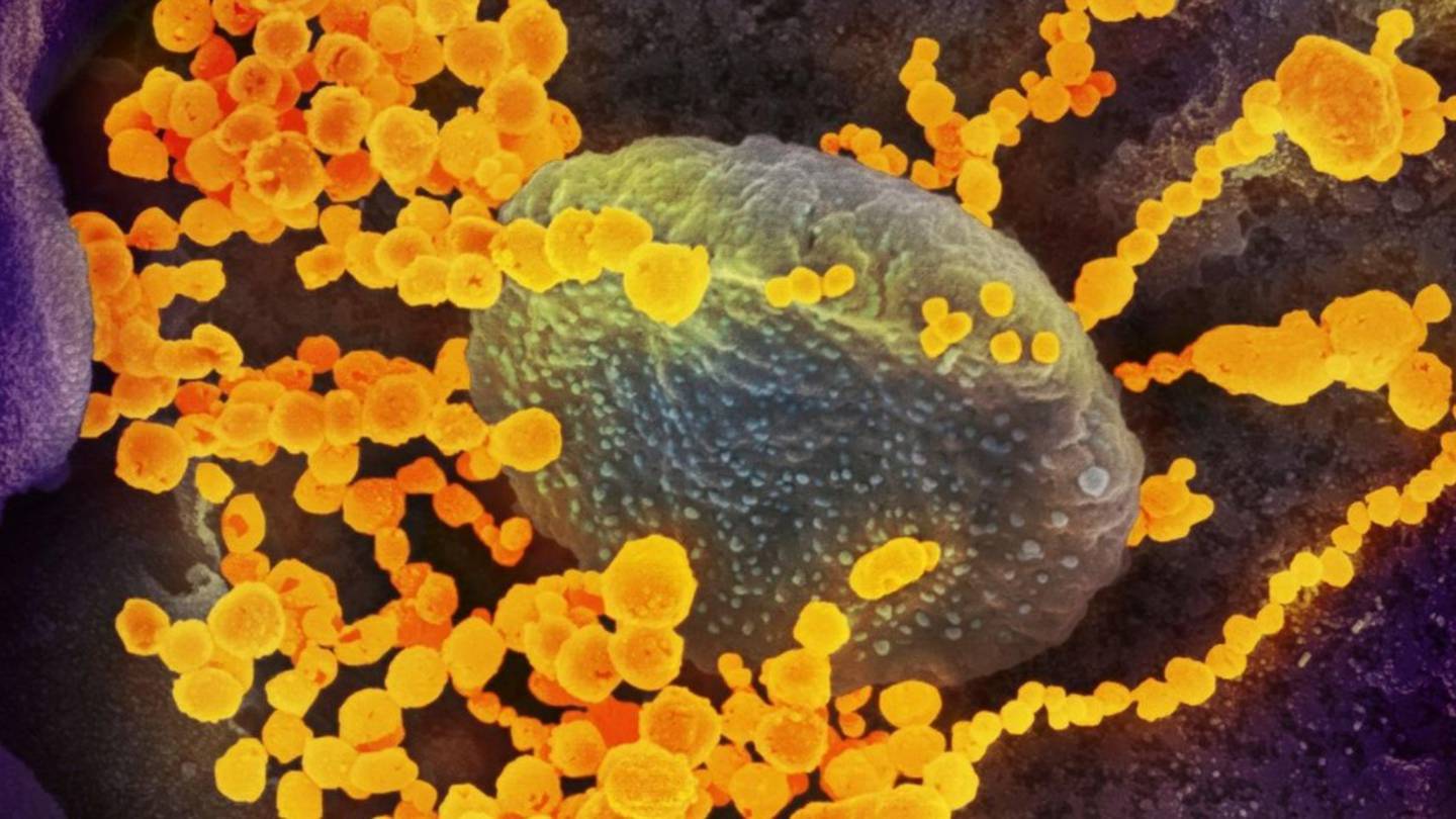 (Photo / National Institutes Of Health)