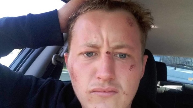 Daniel Bond was wrongly kidnapped and assaulted by police officers. He has won the right to a private prosecution and wants the officers who are charged to stand down from police duties. Photo / Supplied by Daniel Bond