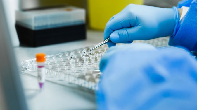 A home DNA test kit helped an 85-year-old woman connect with her estranged siblings. Photo / File