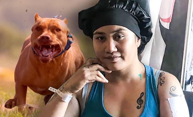 South Auckland mother Trudy Lee is recovering in Middlemore Hospital after she was the victim of a vicious daytime mauling by three stray pit bulls near her home.