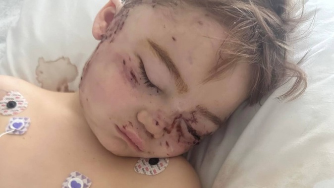 Arlo is in a stable condition at Waikato Hospital after undergoing two surgeries in four days.