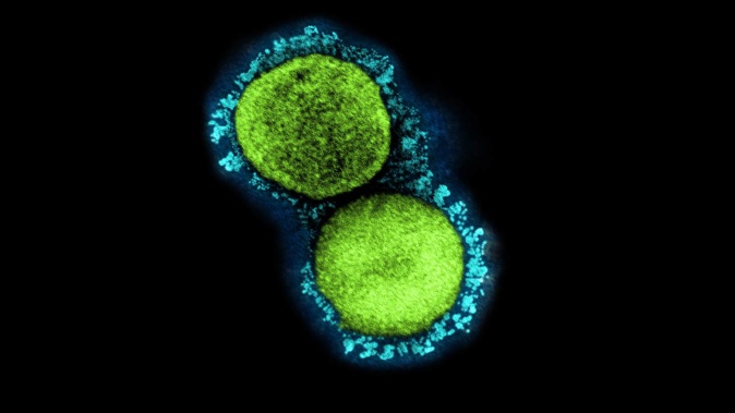 The Ministry of Health is continuing to report thousands of fresh cases – around a quarter of them reinfections – as the country moves through the second of two over-lapping, late-year bumps. (Image / NIAID)