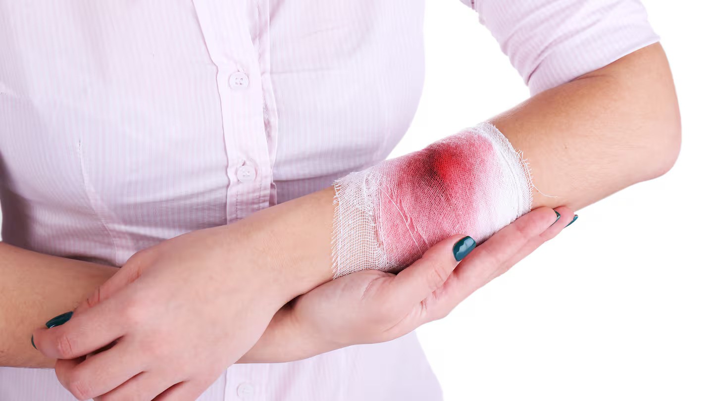 Street attacker ‘growled like dog’ as she bit and latched on to stranger’s arm