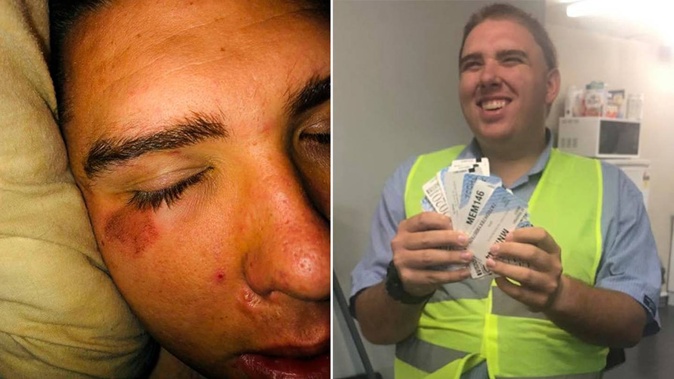 Bradlee Mackay holding some of his beloved registration labels and after he was bashed in a "gutless" attack outside the Green Bay shops in West Auckland in 2019.
