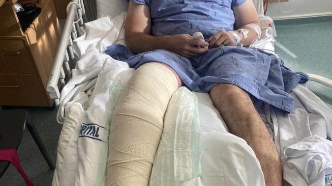 Gareth Godfrey in Waikato Hospital being treated for a broken leg. (Photo / Supplied)