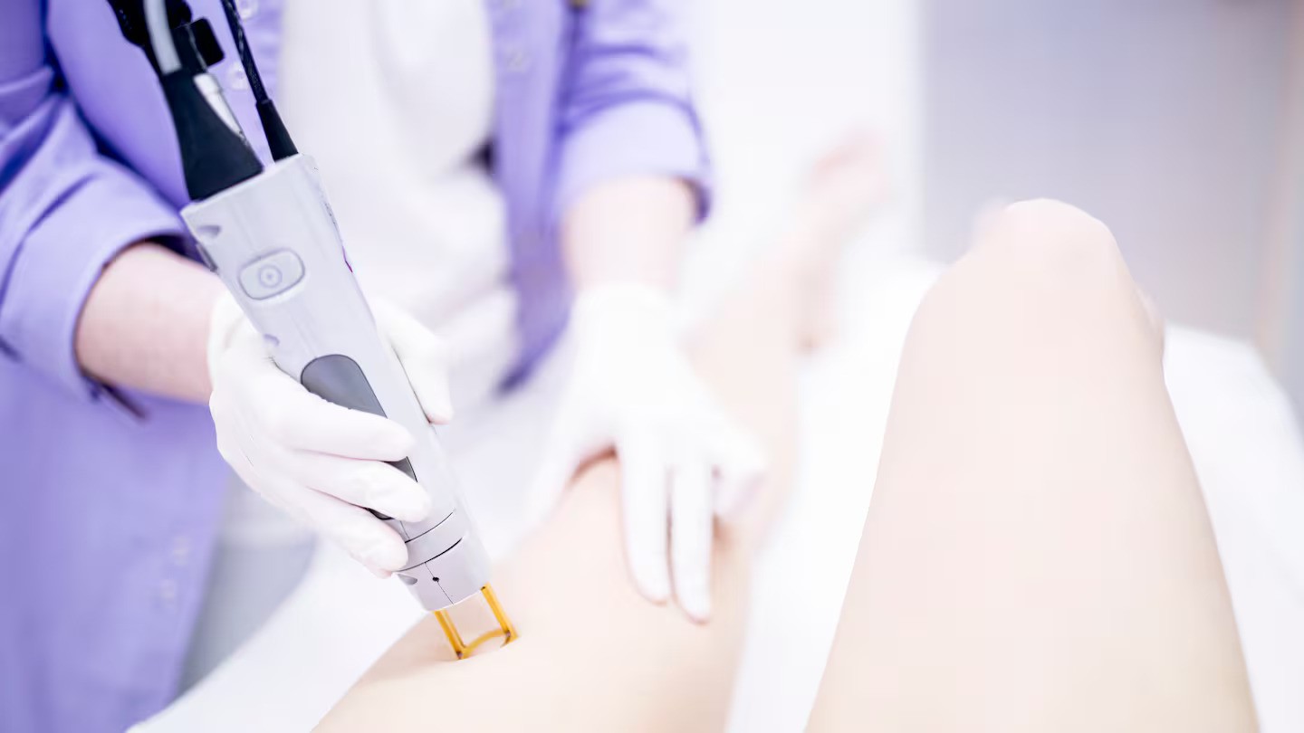 Pain and swelling ignored: Woman left with leg burns after laser treatment