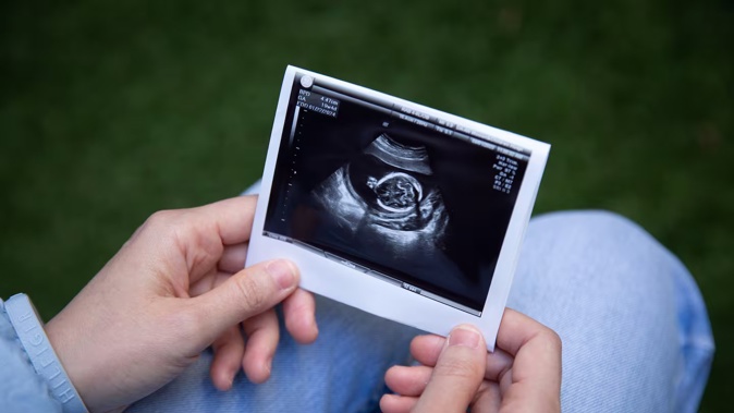 Lana, who lost her baby at 30 weeks after contracting toxoplasmosis, holds a photo from her 12-week ultrasound scan. Photo / Sylvie Whinray