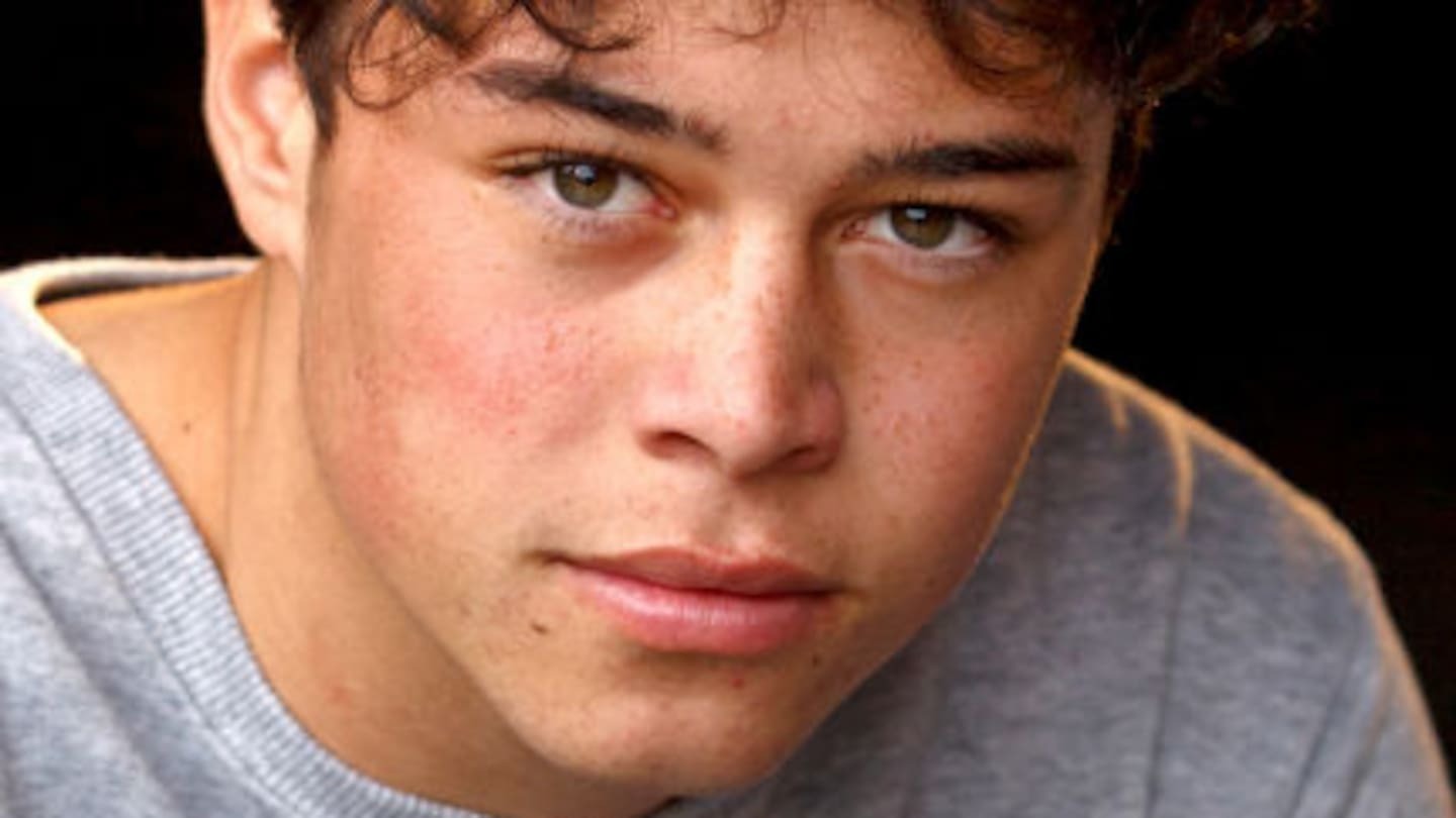Young actor from Shortland Street breaks man’s eye socket in brutal assault