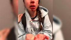 Rotorua mother Tashita Morey is speaking up after her daughter, 13, was beaten at a Rotorua bus stop outside the library. Photo / supplied
