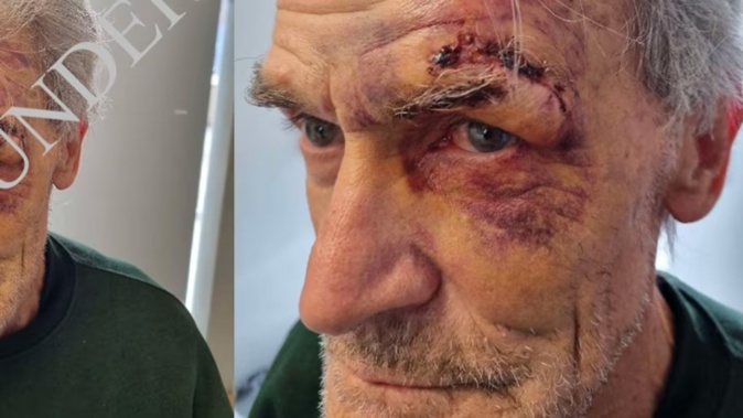 Dean Wickliffe is on day nine of a hunger strike and says he won't eat until he is released from Springhill Prison. Corrections is monitoring his health.