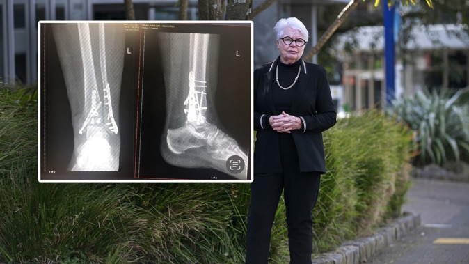 Christine Munro broke her leg in three places after slipping on yellow tactile dots on the corner of Campbell Rd and Anzac St in Takapuna last year. Photo / Alex Burton