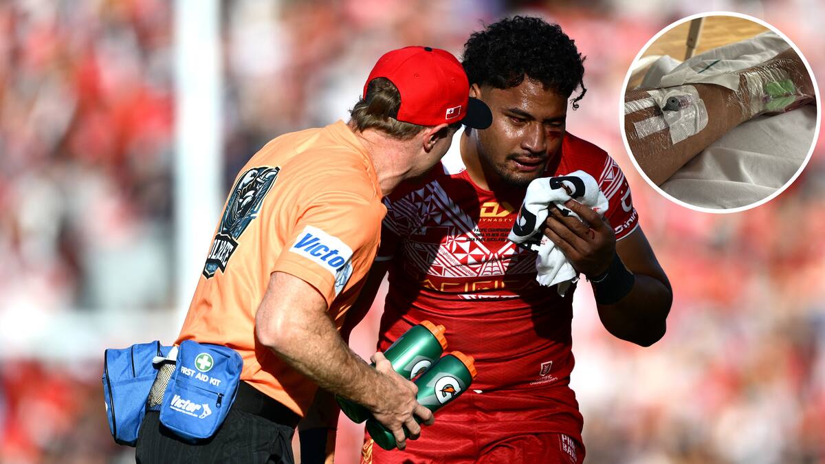 Tonga league star undergoes surgery after ‘suffering seizure activity’ in defeat to Kiwis