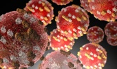 The measles virus, the US CDC says measles is very contagious and can be serious, and anyone who is not protected against the virus is at risk. Photo / US CDC