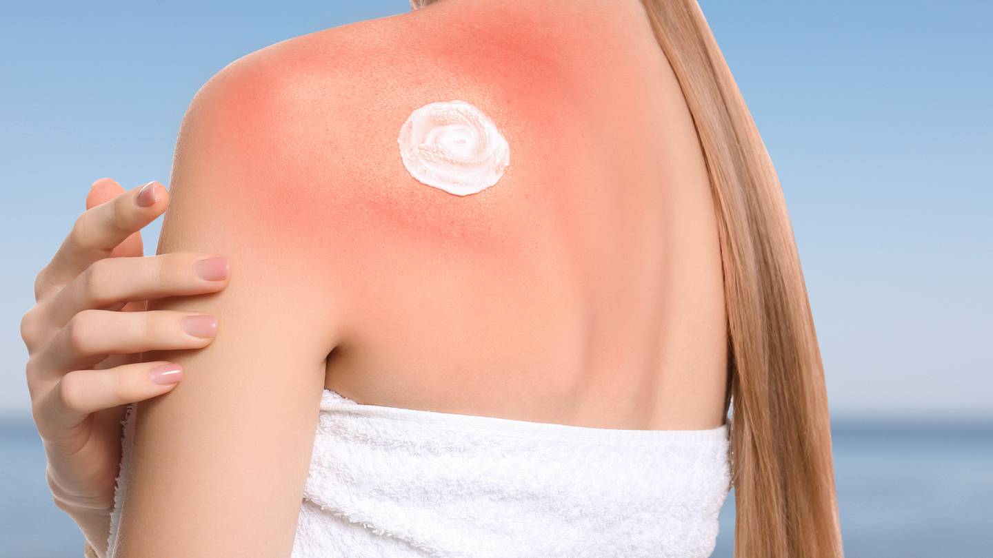 The woman woke up vomiting and struggling to breathe following the phototherapy appointment. Photo / 123RF