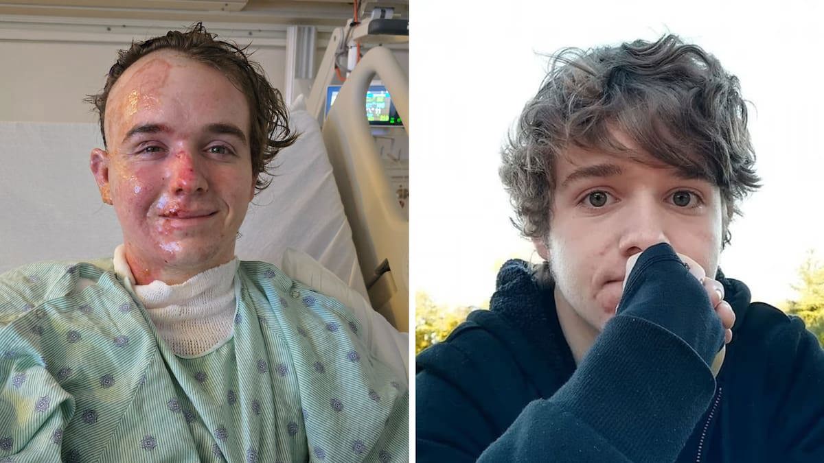 McDonald’s worker faces charges after hot oil attack on mana