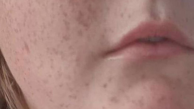 Red marks where the boy (9) said he was assaulted.