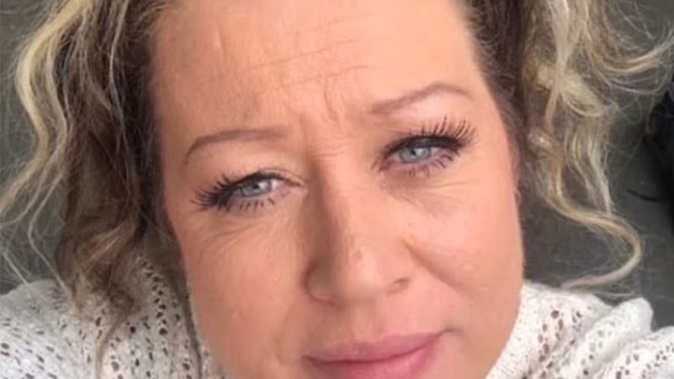 Joanna Kinman, 47, was charged with offensive conduct involving human remains after Victoria police received a tip-off in February that she was attempting to sell a human toe that had been bitten off by a dog.