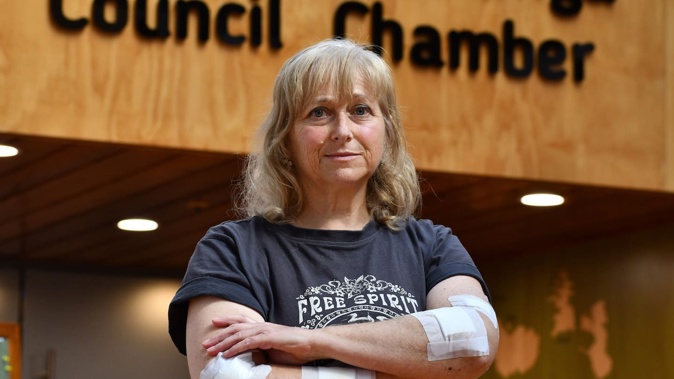 Suz Guet, who was attacked by three dogs in Rotorua, shared her experience with Rotorua Lakes councillors. Photo / Laura Smith