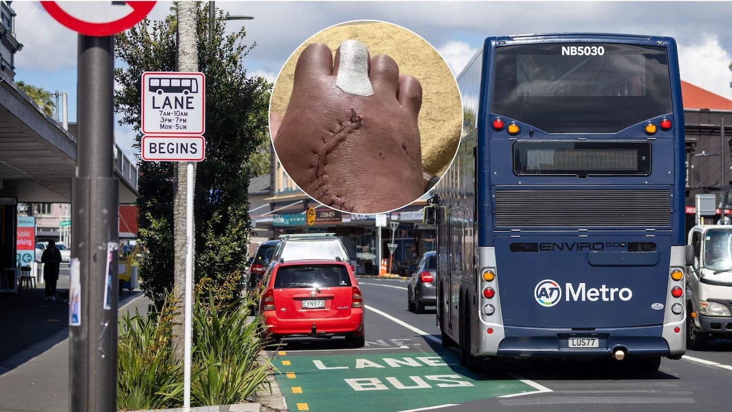 ‘Insulting’: Man run over by bus in hit-and-run says AT offered him $20 Hop card