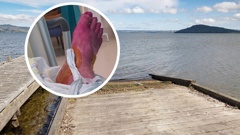 A Rotorua man has been fighting an infection in his foot after stepping on a piece of metal at a public boat ramp. Photos / Andrew Warner, supplied