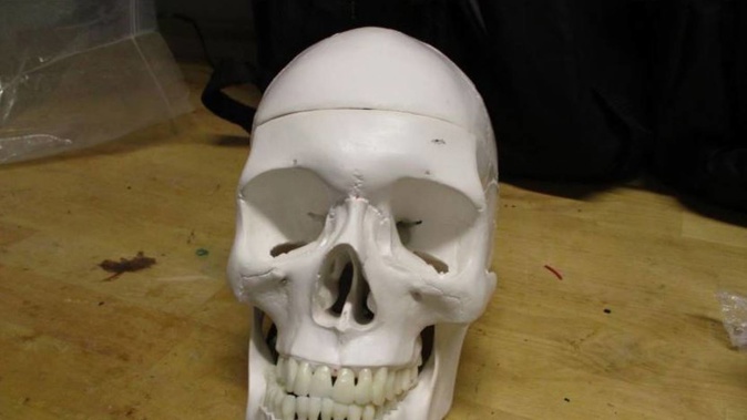 The skull and its attached battery was deemed 'suspicious' by TSA in Salt Lake City International Airport. Photo / TSA