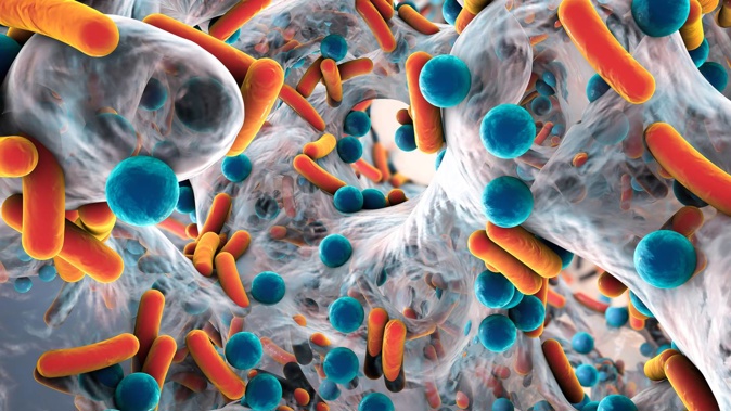 New Zealand's continuing over-use of antimicrobial medicines is raising the danger of drug-resistant superbugs. Photo / 123RF