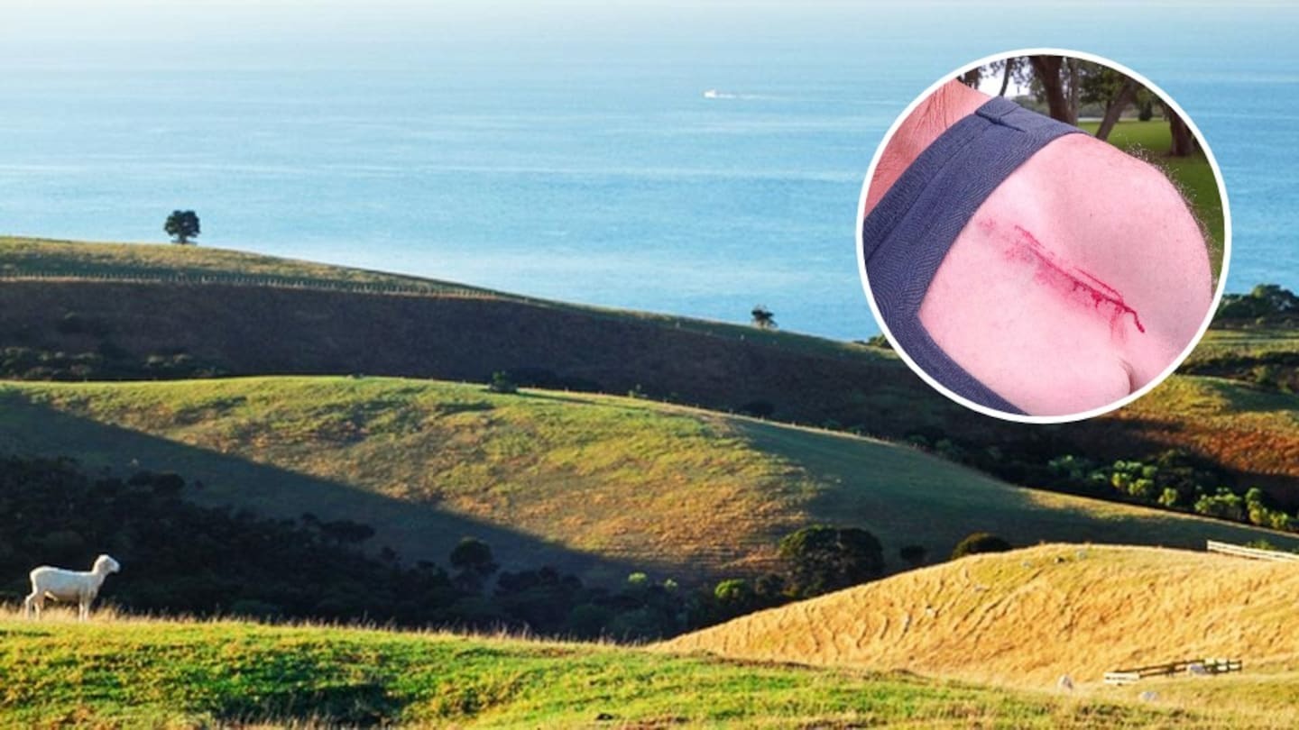 78yo dog walker attacked with broom handle in popular Auckland park after pet off leash