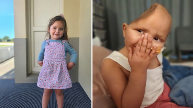 Daisy at age 2 (left), before the discovery of the neuroblastoma, and after she had a third of her skull removed to relieve pressure and allow surgeons access to the fist-sized tumour. Photos / Supplied