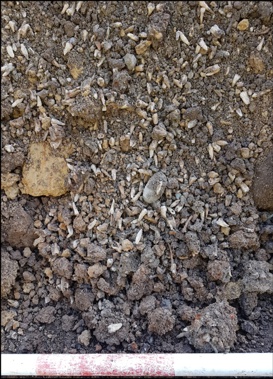 Four years ago, hundreds of teeth from a past era were uncovered on an Invercargill building site. Science has revealed a little of what life was like for the people they belonged to. Photo / Otago University