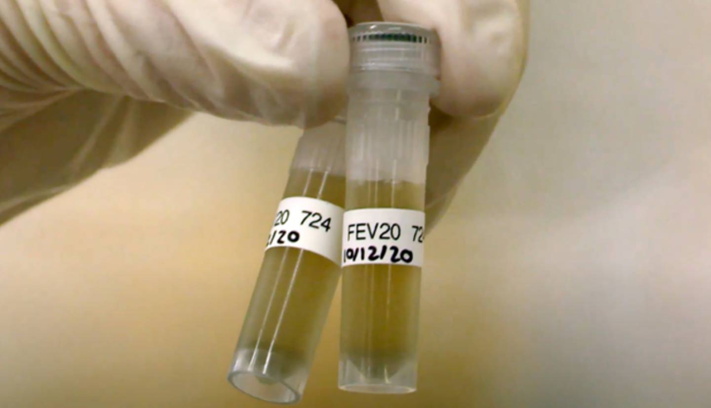 Wastewater surveillance has been crucial in gauging Covid-19's prevalence in New Zealand.