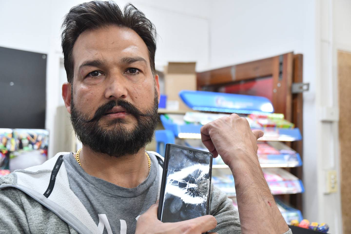 Kawaha Point Dairy and Liquor Centre owner Harshminder Singh shows the injuries he received from an alleged robber. Photo / Laura Smith