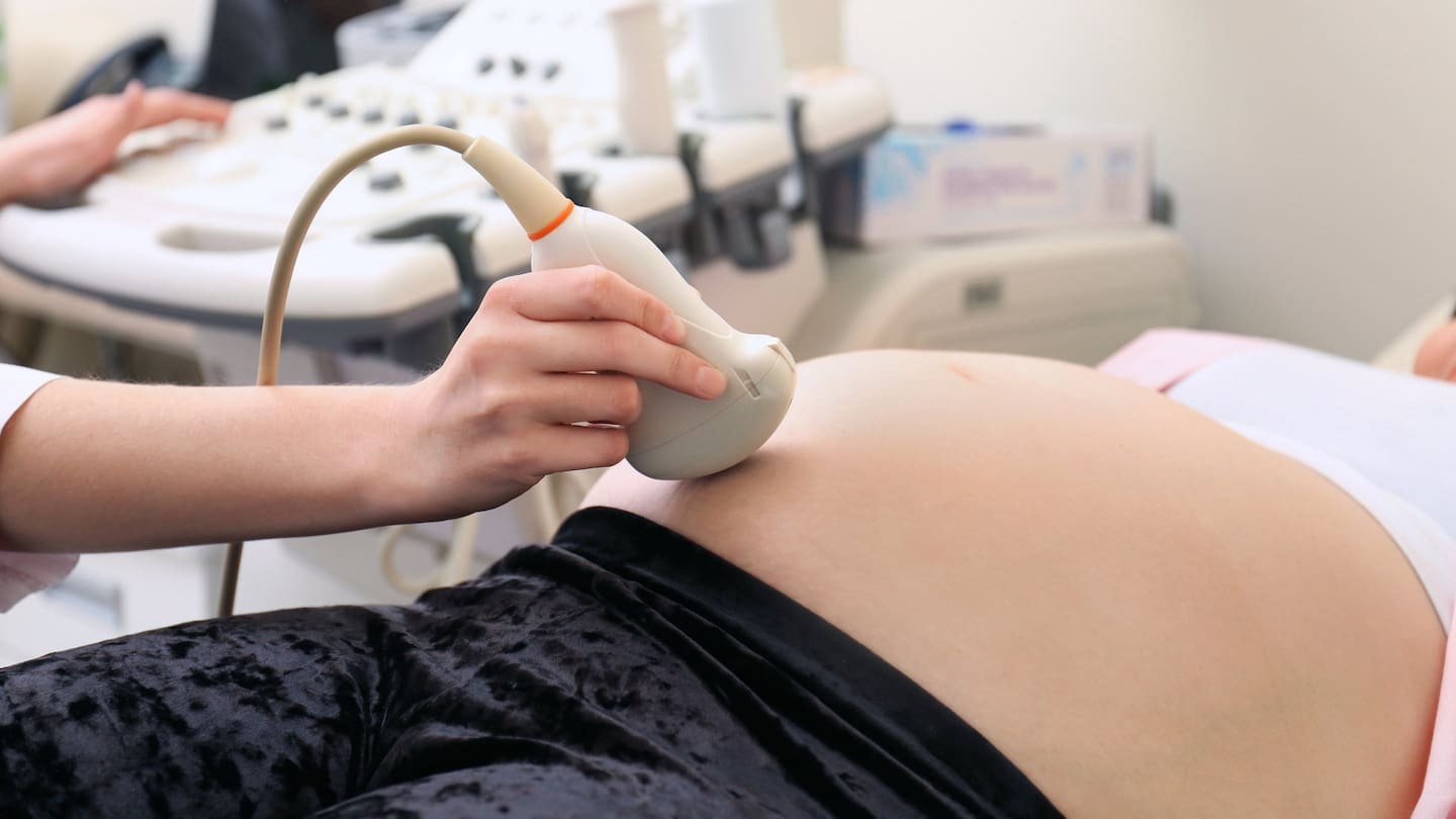 The woman proceeded with her pregnancy because of the low-risk results of her scan. Photo / 123rf