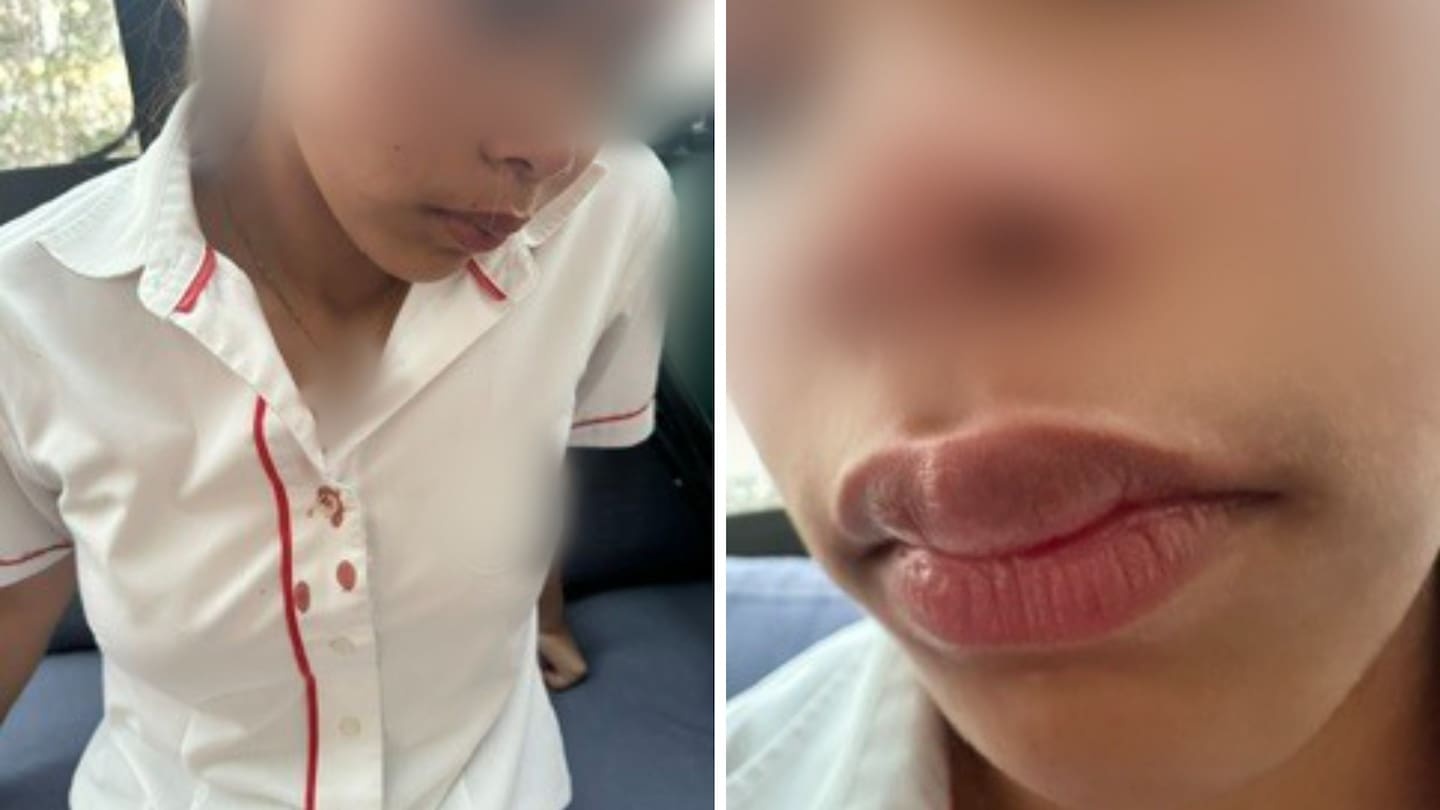 Teen bloodied and traumatised after 'random' attack at Auckland bus stop