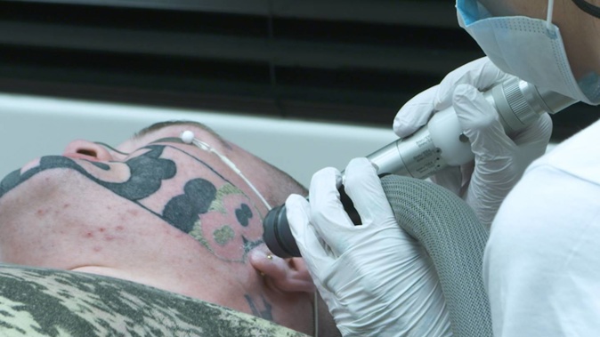 Mark Cropp, who's Devast8 face tattoo prevented him from getting a job, had one session to remove the tattoo at Sacred Laser, which offered to do the job free. Photo / NZ Herald