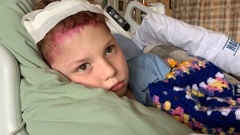 Tauranga boy Jai Anstis after having brain surgery at Starship Hospital on February 12.
