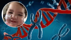 Katana Morunga is battling a rare genetic disease which a 2022 study identified sufferers as having in North and South America and Europe. New Zealand Herald composite photo