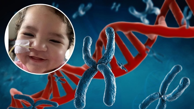 Katana Morunga is battling a rare genetic disease which a 2022 study identified sufferers as having in North and South America and Europe. New Zealand Herald composite photo