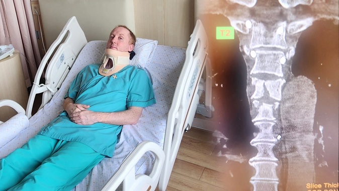 Kiwi violin maker Phil Whitehead had his back and neck broken when the Singapore Airlines flight he was on hit turbulence in May.